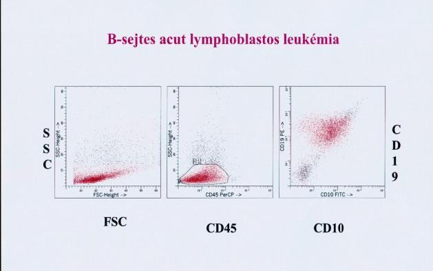 Vérzékenység, láz, sepsis, magas LDH