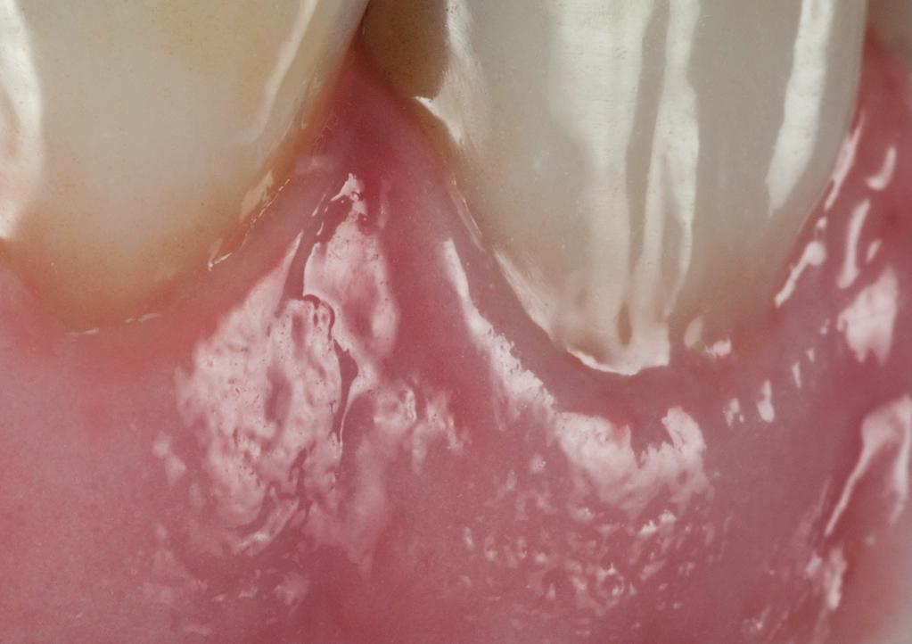 MiYO pink Structure segítségével