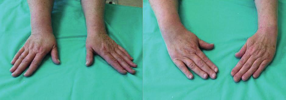 extensio 8.