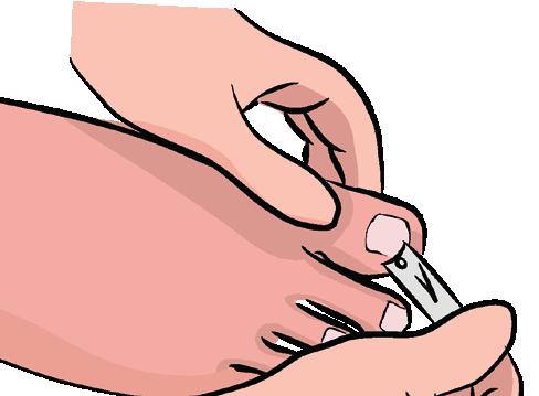 Körömápolás: Ha eléri, és jól látja a lábát, saját maga is elvégezheti a körömvágást. Ezt általában 6-8 hetente kell megtenni. Használjon jó minőségű körömcsipeszt és körömreszelőt!