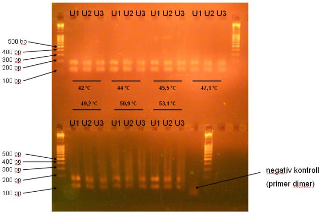 A kapott PCR termékek elválasztása agaróz gélen történt, az ábra a hőmérséklettől való függést
