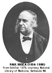 Az első szindróma: Broca-afázia (1861) Broca esete a beszédfolyékonyság súlyos zavara beszédértés csökkent grammatikai komplexitás artikulációs zavar (dysarthria) monotón beszéd (dysprosodia) Spontán