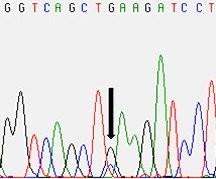 2) Molekuláris genetika Ha a szakember szerint a genetikai betegséget génmutáció okozza, akkor molekuláris genetikai laboratóriumot kér fel a kérdéses gén DNS-ének vizsgálatára.