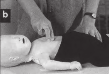 a nem emelkedik a baba mellkasa, akkor ez abból is következhet, hogy valami elzárja a baba légcsövét.