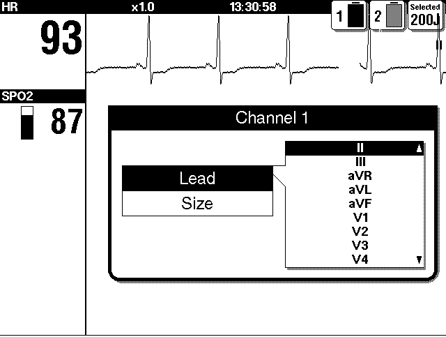 MONITOROZÁS Az EKG-elvezetés kiválasztása vagy megváltoztatása a SELECTOR (Kiválasztás) gomb használatával: 1 Az elsődleges EKG kiválasztásához jelölje ki és válassza ki az 1.