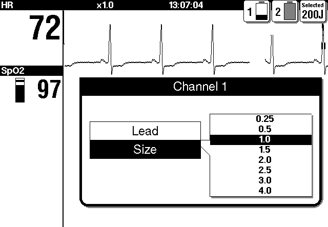 Lásd RIASZTÁSOK Á Í Á Az EKG-elvezetést kétféle módszerrel lehet kiválasztani, illetve megváltoztatni.