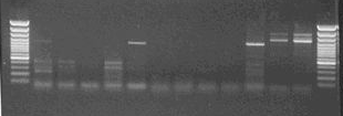 (1998) által leírt degenerált ACS-F és ACS-R primerekkel (4. táblázat) 1200 bp-nyi fragmentumot amplifikáltunk cdns templátról és 1300 bp-nyit genomi DNS-r l (7. ábra).