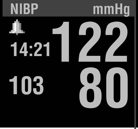 MONITOROZÁS 4 Kézi, egyszeri mérési eljárás Az NIBP-mérés többnyire körülbelül 40 másodpercet vesz igénybe.