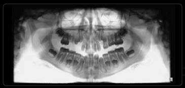 Idén a Nekem 8 hajó végzett az első helyen, Egressy Dental/Wilconee csapat néven, Erdős Bálint vezetésével.