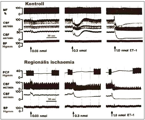 Az endothelin-1 emelkedő bólusait a coronaria érbe szúrt vékony (26 Ga) tűn keresztül (I. és II. csoport), illetve közvetlenül a perfúziós rendszerbe (III.) adtuk.