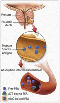 PSA Glikoprotein,prostata epithelsejtjei termelik Referens tartomány korfüggő Szűrés alkalmas Prosztatarák diagnózisa PSA