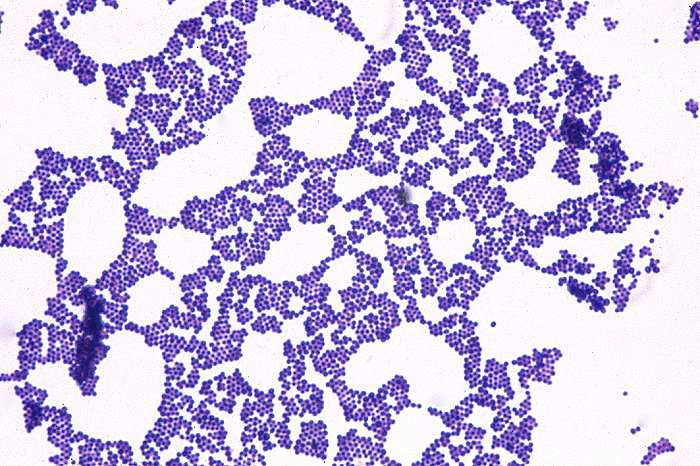 Humán patogén eubaktériumok Gram pozitívok Proteobacteria α-proteobacteria (Ehrlichi Bartonell Brucell Rickettsi Rhizobium) β-proteobacteria (Neisseri