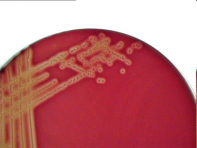 nélküli baktériumok (Mycoplasmatales; a Gram pozitívok filogenetikai rokonai) Saválló (sejtfalú) baktériumok (Mycobacteriumok; a Gram pozitívok