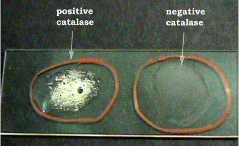 baktériumok Mycobacterium Nocardia Sejtfal nélküli baktériumok Mycoplasma Gram pozitív coccusok Staphylococcus Koaguláz pozitív S.