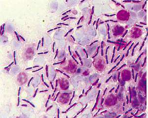 Gram pozitív pálcák Aerob/fakultatív anaerob: Bacillus B. anthracis, B. cereus, B. subtilis Listeria L. monocytogenes Corynebacterium C.