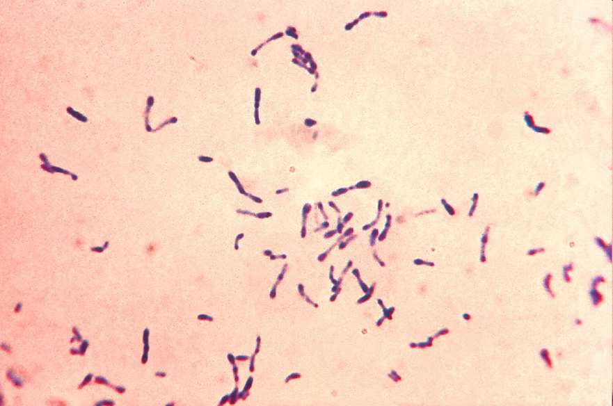 israeli, A. naeslundii, stb. Propionibacterium P. acnes Gardnerella G.
