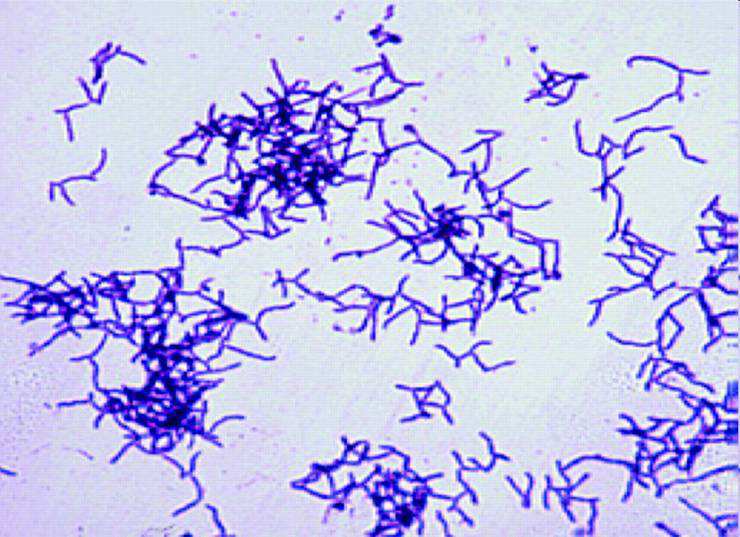 (aktuálisan változó taxonómia) (ritka humán patogének Rhodococcus) Sejtfal nélküli baktériumok Mycoplasma M. hominis, M. pneumoniae, stb.