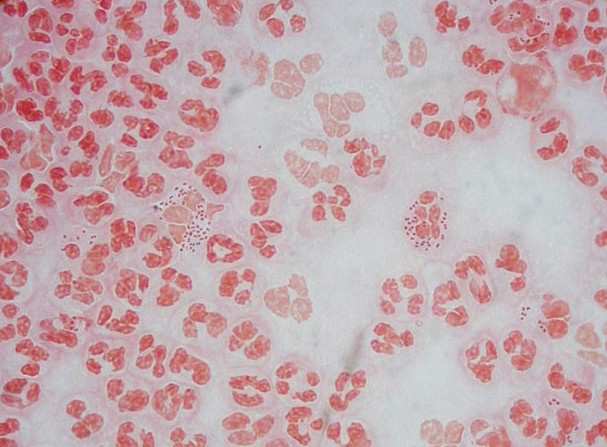 Neisseria gonorrhoeae Francisella tularensis Gram negatív pálcák Enterobacteriaceae Escherichia E. coli Shigella (az E. coli-val egy genom-species) S. dysenteriae, S. flexneri, S. boydii, S.