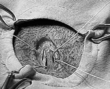 ábra Tompa preparálás Helyszín: Hallgatói műtő Téma: A kardiovaszkuláris rendszer komplex in vivo monitorozása, aszeptikus technika alkalmazásával.