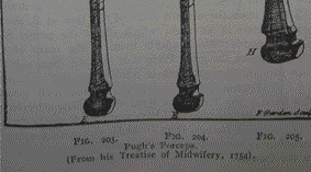 Benjamin Pugh (1710 1775), egy harmadik essexi (Chapman és Giffard után) különösen kiemelkedô szerepet játszott a Chamberlen-típusú fogó fejlesztésében.