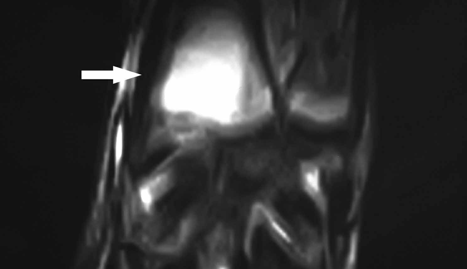 2004/1 OSTEOLOGIAI KÖZLEMÉNYEK 21 2 d 2 e 2 d kép.