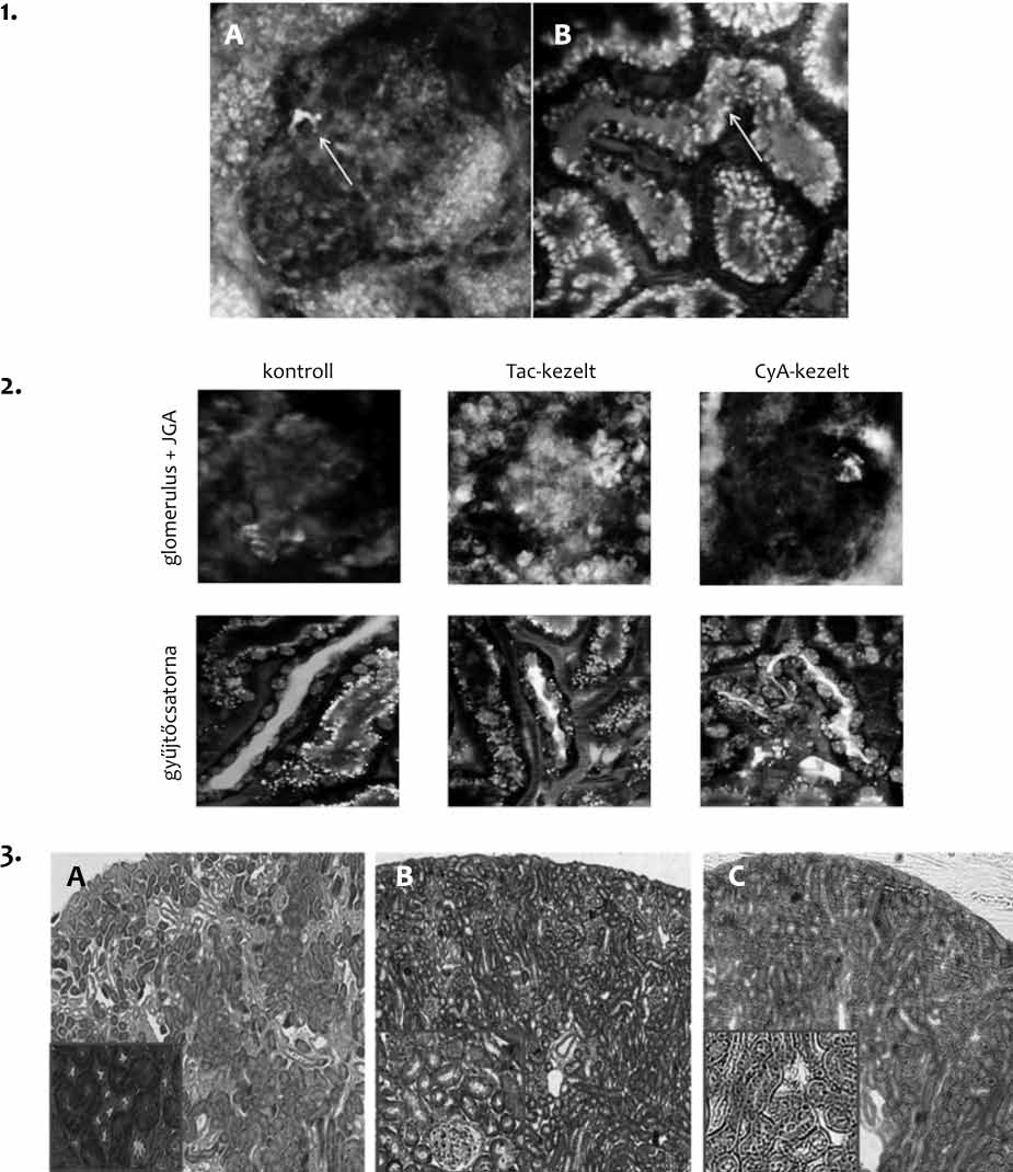 Prókai et al. A reninszekréció vizsgálata Tízezer sejtet gyűjtöttünk össze, és a belőlük származó adatok kerültek analízisre. Statisztikai analízis Az adatokat STATIS- TICA.6 szoftverrel analizáltuk.