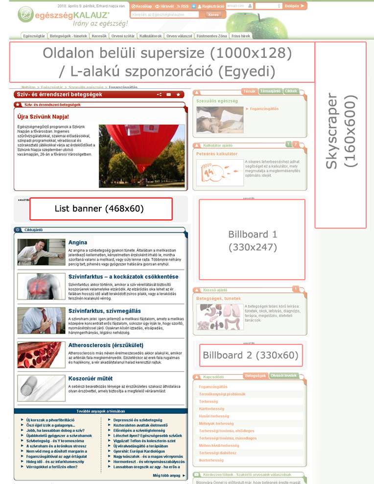 ROVAT ÉS CIKK SZPONZORÁCIÓ MINTÁK Rovat- és cikk szponzoráció esetén egy oldalon mutatjuk be, milyen lehetőségek