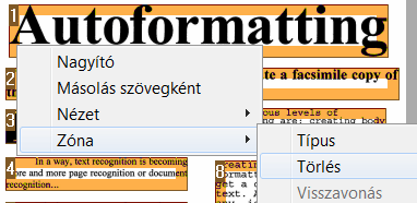 Readiris TM 14 - Felhasználói útmutató A két zóna egy zónává olvad össze. Megjegyzés: csak az azonos zónatípusú zónákat lehet összekapcsolni.