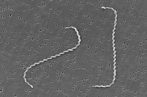 Leptospira