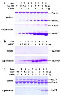 filamentum F R E T Förster type resonance energy transfer 1 donor-akceptor párral jelölve Gln-41 labelled by FITC (cceptor) TP intramolekuláris flexibilitás Cys-374 labelled by IENS (onor) IM-lipid