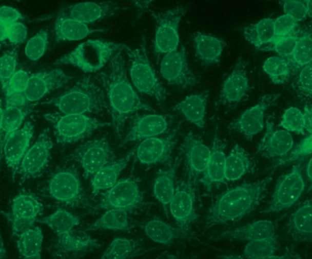 A PBC-re specifikus ANF pozitivitás AMA negatív PBC vagy autoimmun cholangitis Immunfluorescens módszerrel 1. Multiple nuclear dots (MND) Antigén: Gp210 2.