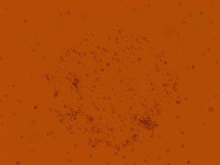 Átlagos sejtszám Tisztitott neutrofil granulocita kötődése immunkomplexhez kapilláris rendszerben Kinyomtatott RA specifikus peptid antigének IgG1 IgG2 IgG3 IgG4 HCP2 VCP2 8 Pozitív RA szérum