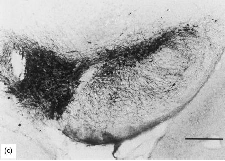 peroxinitrit okozta sejt- és DNA károsodást, azonban nem szelektív NOS gátlás L- nitroargininnel nem eredményezett neuroprotekciót (Mackenzie et al., 1997).