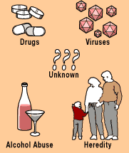 A krónikus hepatitis okai: vírushepatitisek (HBV, HCV, stb) autoimmun májbetegségek alkohol és gyógyszer-okozta