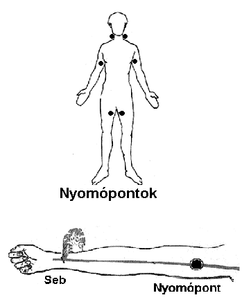 Ütőeres és gyűjtőeres vérzés Ezek a vérzések mindenféleképen súlyos vérveszteséget okoznak, ezért a sérültet azonnal orvoshoz kell vinni.