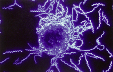 1 1. ábra. Borrelia burgdorferi sensu lato spirális baktériumok sötét látóterû mikroszkópban (Forrás: http://www.microbelibrary.org) Figure 1.