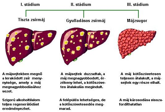 A májproblémáknak számos oka lehet, így megelőzésük és kezelésük is különféle módokon lehetséges: 1. Fertőzések: vírusok, baktériumok A legkritikusabb a Hepatitis B és C vírusfertőzés.