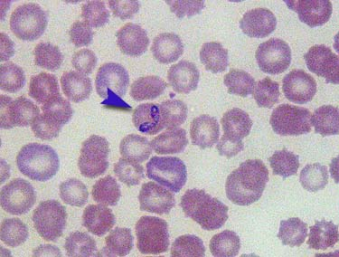 3.8. A babesiosis kimutatása az állatorvosi gyakorlatban Az állatorvosi gyakorlatban a babesiosis kimutatása alapesetben nem PCR módszerrel történik, mert bár nagyon pontos, megbízható módszer,