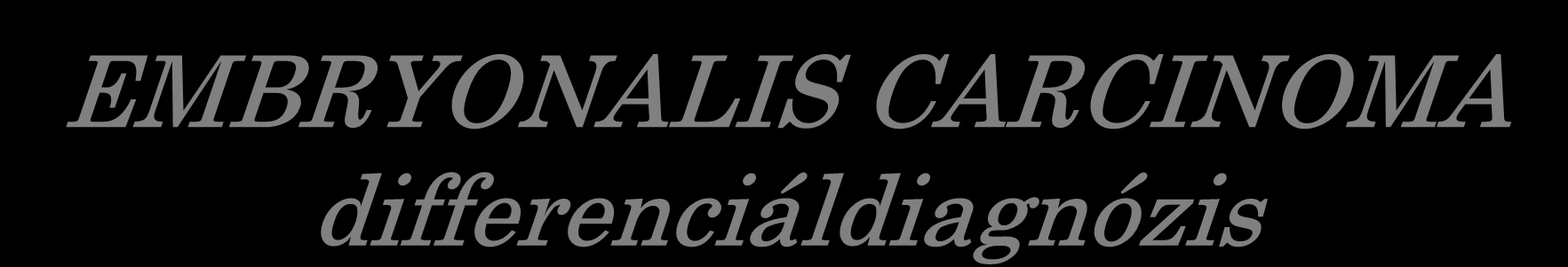 EMBRYONALIS CARCINOMA differenciáldiagnózis Seminoma/ dysgerminoma (CD30, AE1/AE3, CK7, c-kit) Yolk sac tumor