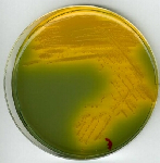 LAB091 E.E. Broth (Enterobacteriaceae Enrichment Broth) Enterobacteriaceae spp. dúsítására használt tápleves, amelyet élelmiszerek és élelmiszer alapanyagok vizsgálata esetén használnak.