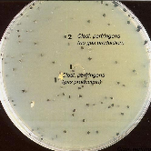 LAB108 Pseudomonas CN agar A King s táptalaj módosítása, amely a magnéziumot és a kálium sókat alkalmazza a pigment termelés (pyocianin, fluorescein) fokozására. A táptalaj az X107 C.N. supplement hozzáadásával lesz szelektív a Pseudomonas aeruginosa-ra.