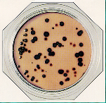 LAB111 Sabouraud Maltose Agar A Sabouraud Dextrose Agar módosítása, a dexróz tartalom maltózzal való helyettesítése által.