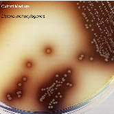 LAB122 Listeria Isolation Medium (Oxford Medium) Egy szelektív, izoláló közeg Listeria monocytogenes elkülönítésére klinikai és élelmiszer mintákból.