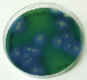 LAB186 D/E Neutralising Broth Base LAB187 D/E Neutralising Broth LAB188 D/E Neutralising Agar Tápanyagokban gazdag tápközeg, egyáltalán nem tartalmaz neutralizáló komponenseket.