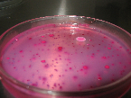 LAB029 D.C.A. (Desoxycholate Citrate Agar) Leifson táptalaján alapuló, szelektív formula, ami Salmonella spp. És Shigella spp. Elkülönítésére szolgál, környezeti és faeces mintákból.