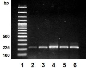 12. ábra. 225 bp mérető DNS fragmentumok, C típusú C.