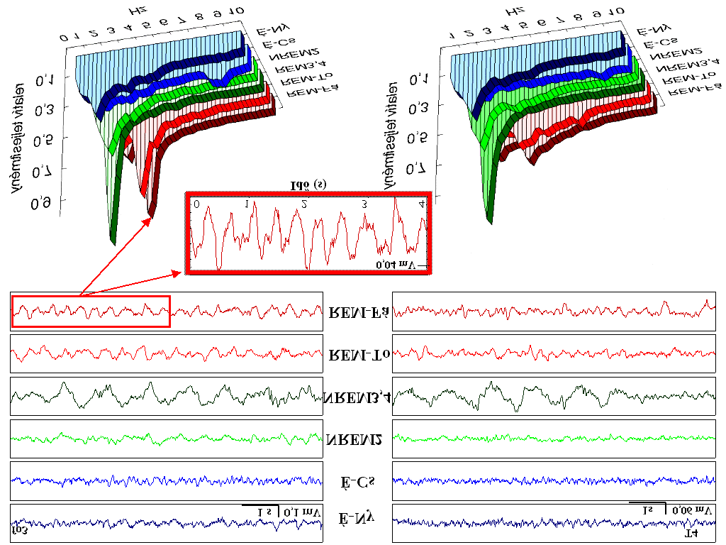 alvásszakaszokban kiemelkedő 1,50-3,00 Hz-es tevékenység. A NREM és a REM alvás tehát különbözött a domináns frekvencia tekintetében.