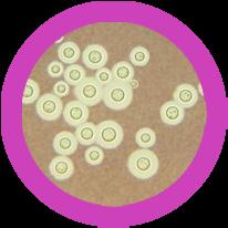 Penicillium Saccharomyces Tinea Stachybotrys Max. méret (nm) Fajok... száma... Az emberre veszélyes Az... ember számára hasznos 332, 000 16 64 198 Antibiotikum-rezisztencia... n.a.... A Penicillium az a gombafajta, amely szó szerint megváltoztatta a világot.