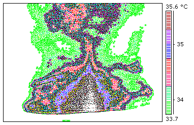 2. alany, csontvizsgálat, hölgy, GMJ-né (beadás elıtt, 60 perces, 90