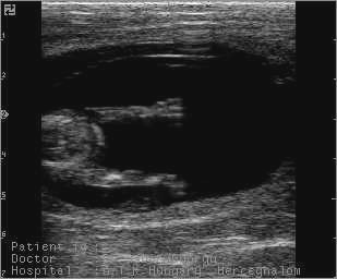 Picture 1.: Computer assisted pixel analysis of the bull testicular echo texture A bal és jobb here ultrahangos képe az ábra bal oldalán látható.